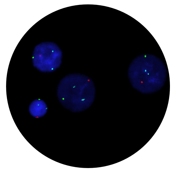 Fluorescence in situ hybridisation (FISH) microscope image of the CytoCell Prenatal X, Y, 13, 18 and 21 probe.