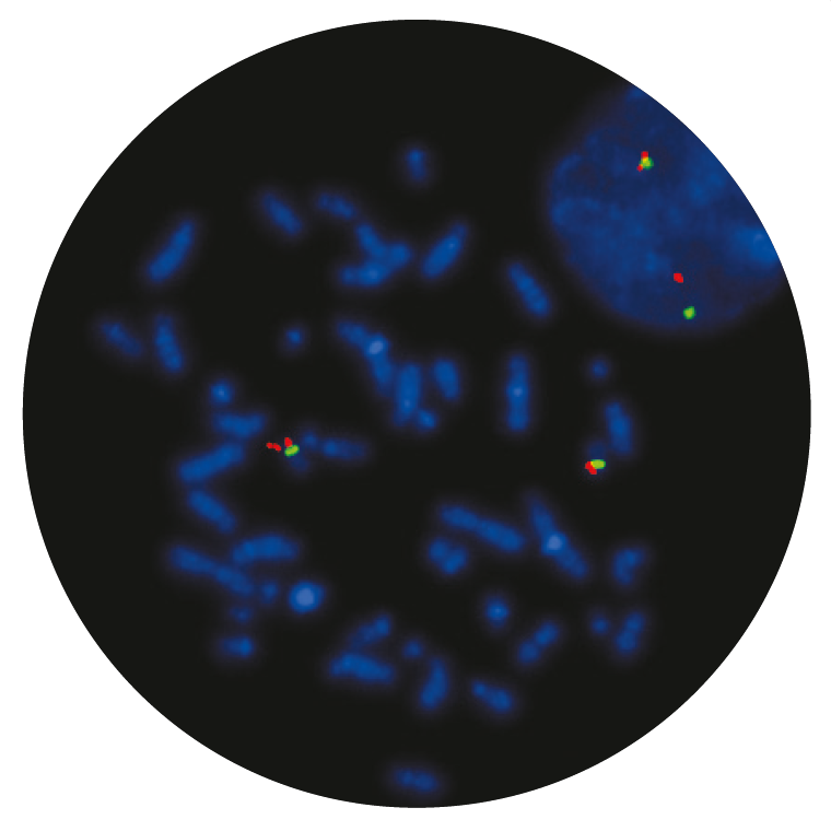 Fluorescence in situ hybridization (FISH) microscope image of the CytoCell P53 (TP53) Deletion probe.