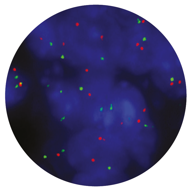 Fluorescence in situ hybridisation (FISH) microscope image of the CytoCell HER2 (ERBB2) Amplification probe.
