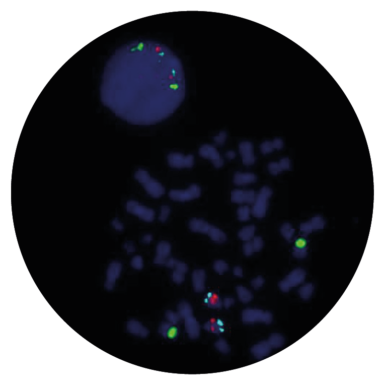 Fluorescence in situ hybridisation (FISH) microscope image of the CytoCell D13S319/13qter/12cen Deletion/Enumeration probe.