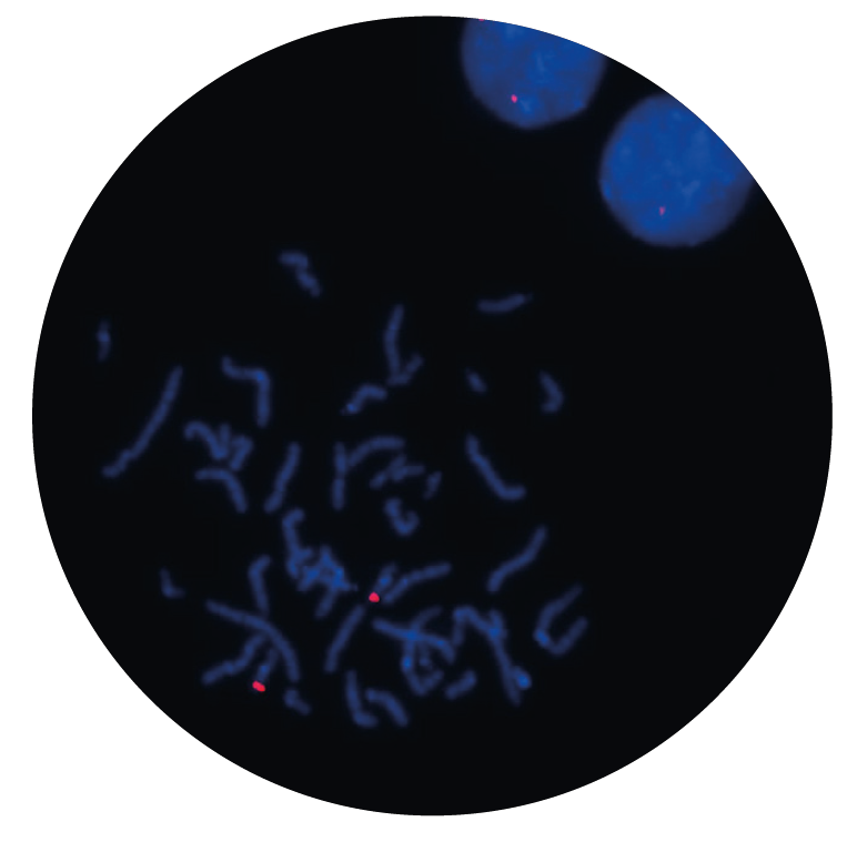 Fluorescence in situ hybridization (FISH) microscope image of the CytoCell MAF v2 Probe Red.