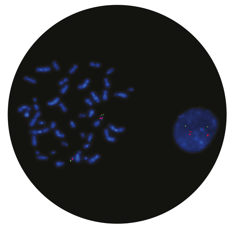 Fluorescence in situ hybridization (FISH) microscope image of the CytoCell DiGeorge/VCFS N25 Region and 22q13.3 Region probe.