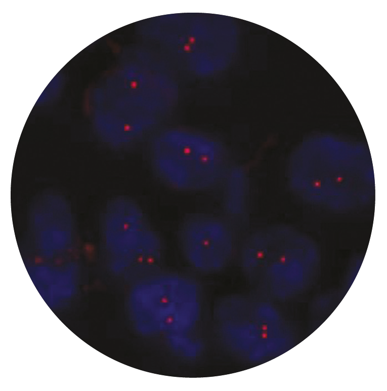 Fluorescence in situ hybridization (FISH) microscope image of the CytoCell 19q13 probe.