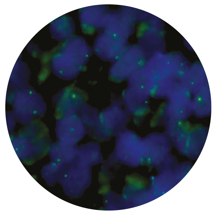 Fluorescence in situ hybridization (FISH) microscope image of the CytoCell TFE3 Distal Probe Green.