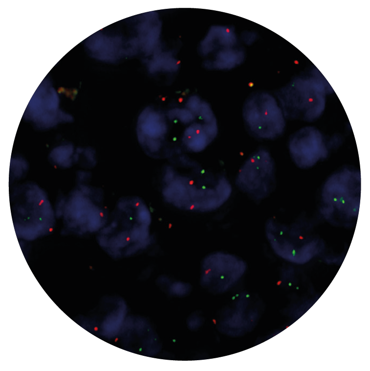 Fluorescence in situ hybridization (FISH) microscope image of the CytoCell IGH/BCL2 Translocation, Dual Fusion probe.