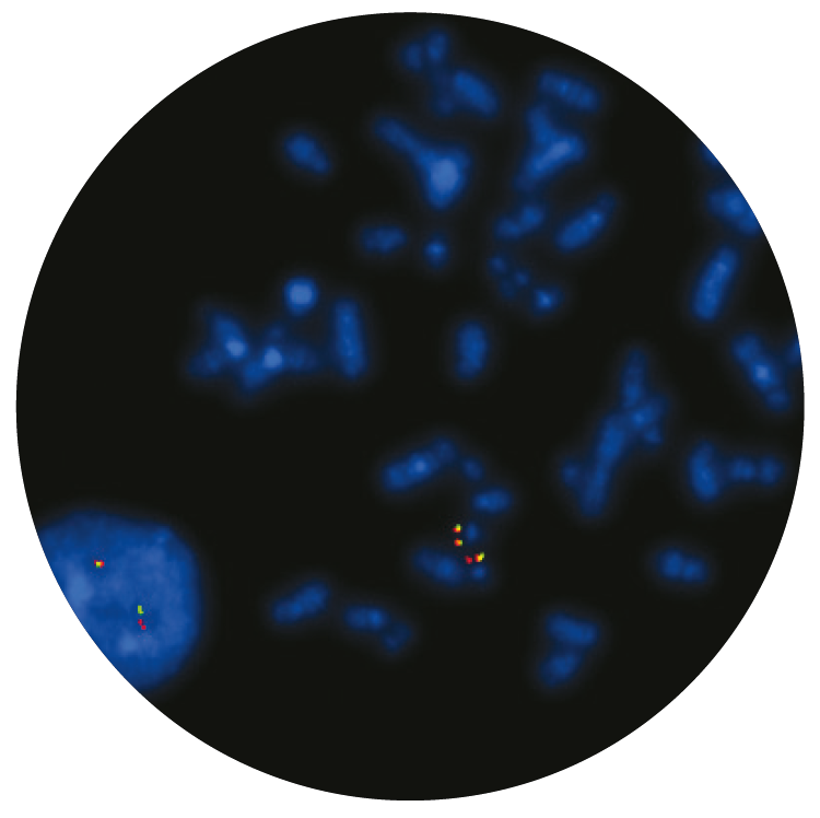 Fluorescence in situ hybridization (FISH) microscope image of the CytoCell E2A (TCF3) Breakapart probe.