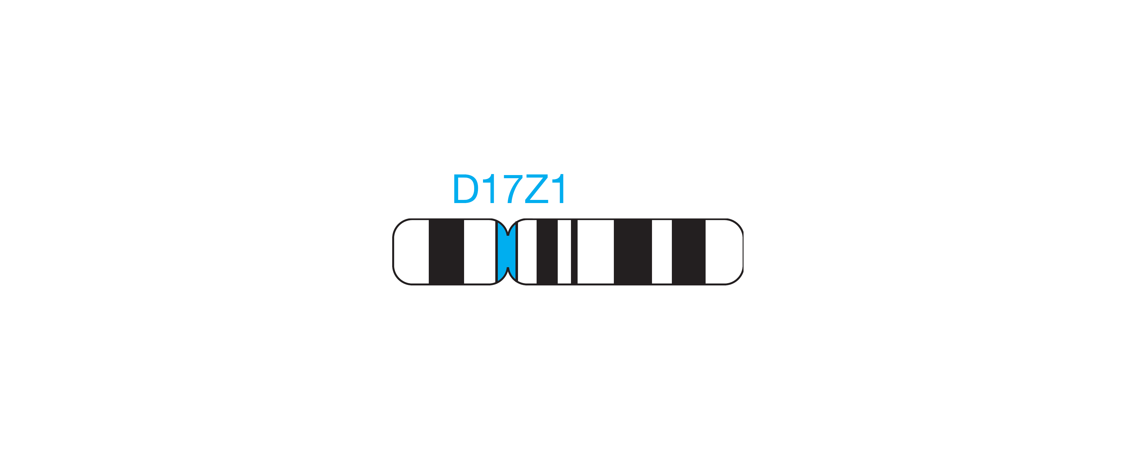 Fluorescence in situ hybridization (FISH) chromosome map showing a probe targeting the region 17cen (D17Z1).