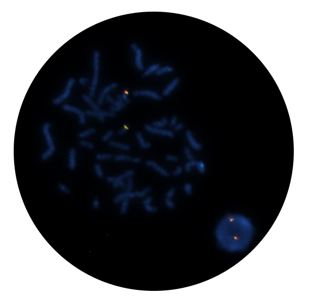 Fluorescence in situ hybridisation (FISH) microscope image of the CytoCell CBFB Breakapart probe.