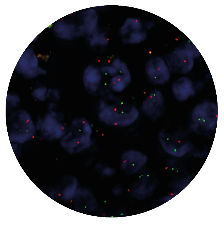 Fluorescence in situ hybridisation (FISH) microscope image of the CytoCell IGH/BCL2 Translocation, Dual Fusion probe.