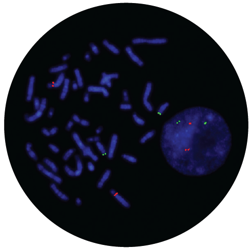 Fluorescence in situ hybridisation (FISH) microscope image of the CytoCell IGH/CCND3 Translocation, Dual Fusion probe.