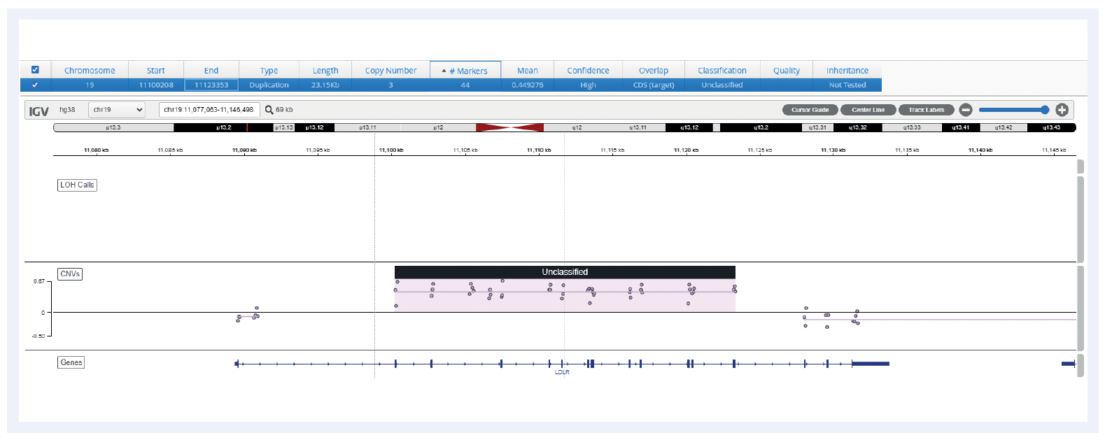 Next generation sequencing (NGS) software data showing a duplication on the LDR gene.