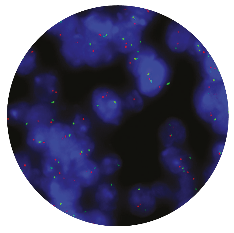 Fluorescence in situ hybridization (FISH) microscope image of the CytoCell TOP2A Amplification/Deletion probe.