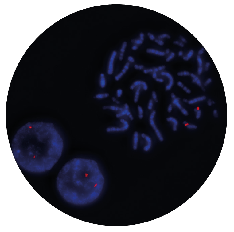 Fluorescence in situ hybridization (FISH) microscope image of the CytoCell FAST PML probe.