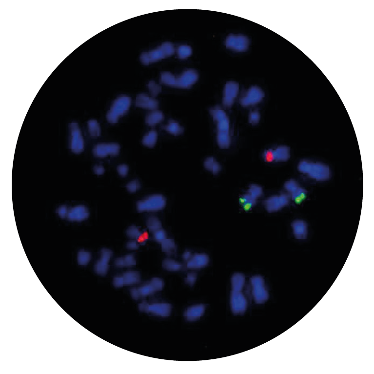 Fluorescence in situ hybridisation (FISH) microscope image of the CytoCell MLL/MLLT3 Translocation, Dual Fusion probe.