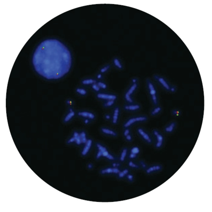 Fluorescence in situ hybridization (FISH) microscope image of the FDA-cleared CytoCell Del(20q) Deletion probe.
