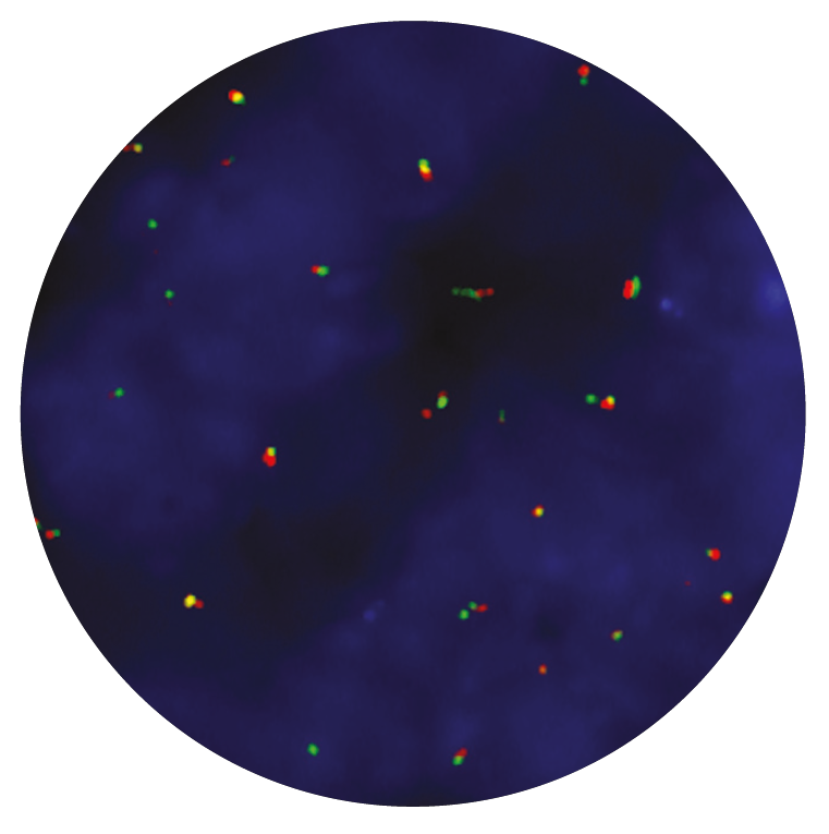 Fluorescence in situ hybridization (FISH) microscope image of the CytoCell CCND1 Breakapart probe.