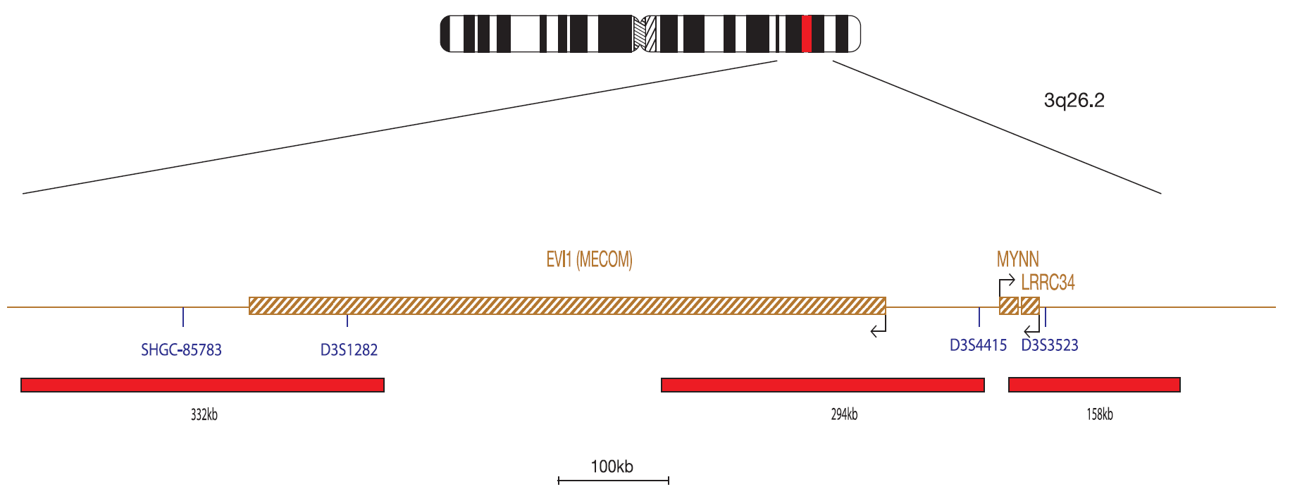 Fluorescence in situ hybridization (FISH) chromosome map showing a probe targeting the EVI1 (MECOM) gene.