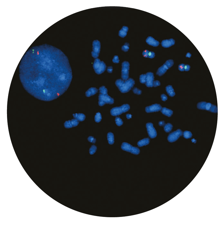Fluorescence in situ hybridization (FISH) microscope image of the CytoCell ATM Deletion probe.