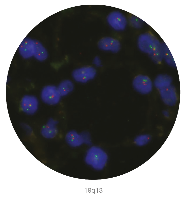 Fluorescence in situ hybridisation (FISH) microscope image of the CytoCell 19q13/19p13 Deletion probe.
