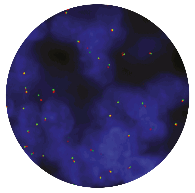 Fluorescence in situ hybridization (FISH) microscope image of the CytoCell cMYC (MYC) Breakapart probe.