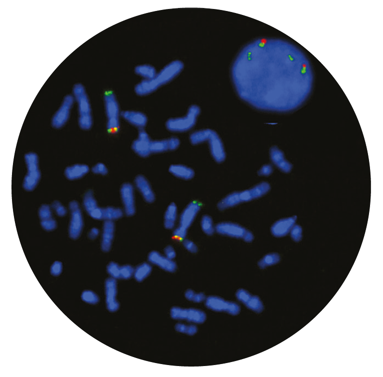 Fluorescence in situ hybridization (FISH) microscope image of the CytoCell Cri-du-chat and SOTOS Region probe.