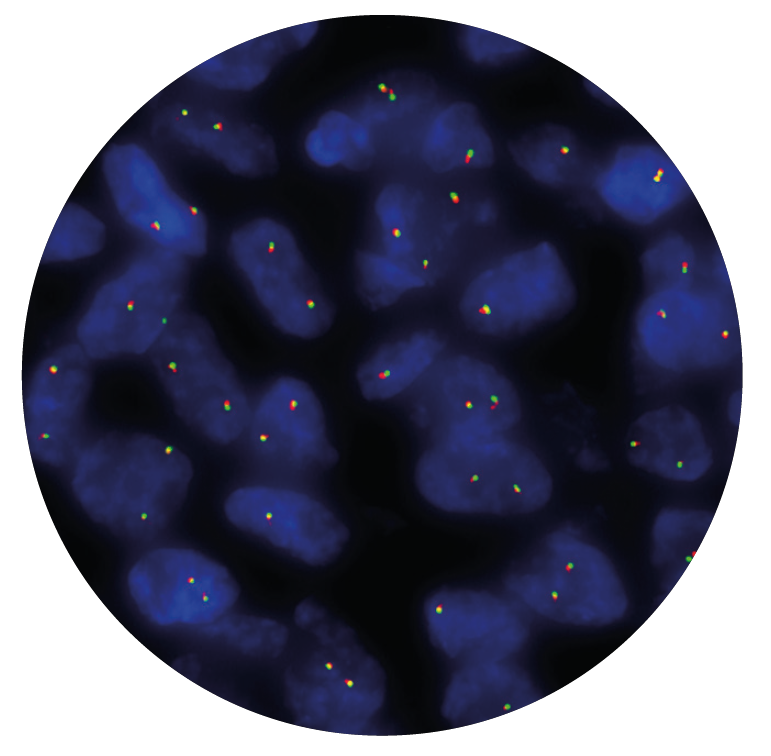 Fluorescence in situ hybridization (FISH) microscope image of the CytoCell ROS1 Breakapart probe.