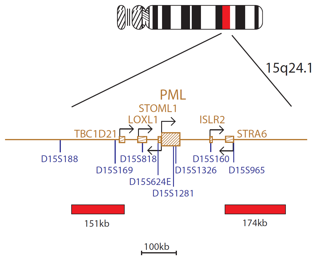Fluorescence in situ hybridisation (FISH) chromosome map showing a probe targeting the PML gene.