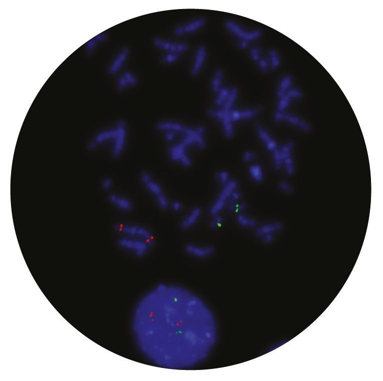 Fluorescence in situ hybridization (FISH) microscope image of the CytoCell PML/RARα (RARA) Translocation, Dual Fusion probe.