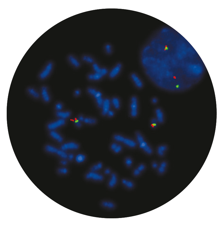 Fluorescence in situ hybridisation (FISH) microscope image of the CytoCell P53 (TP53) Deletion probe.