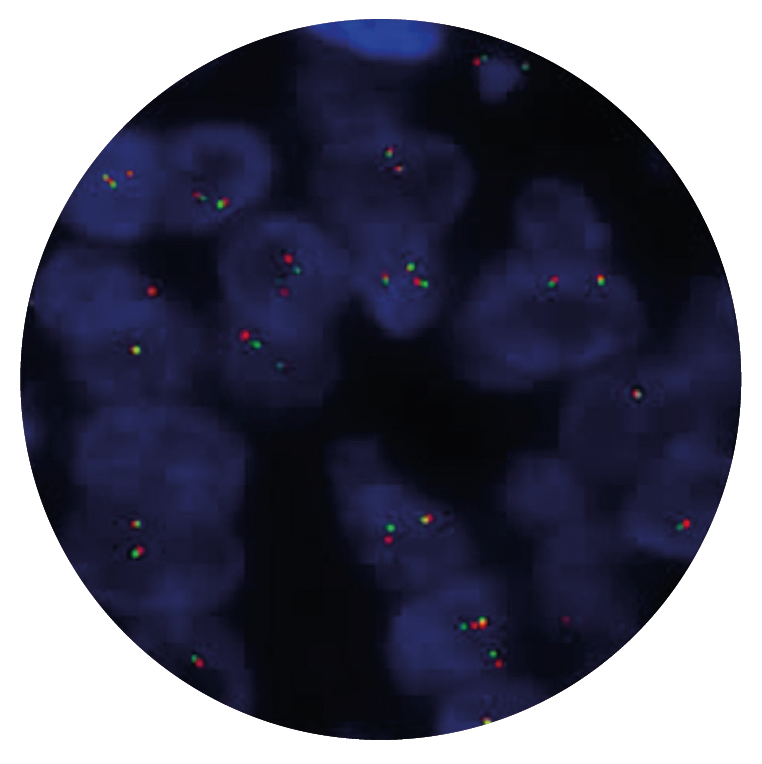 Fluorescence in situ hybridisation (FISH) microscope image of the CytoCell EWSR1 Breakapart probe.