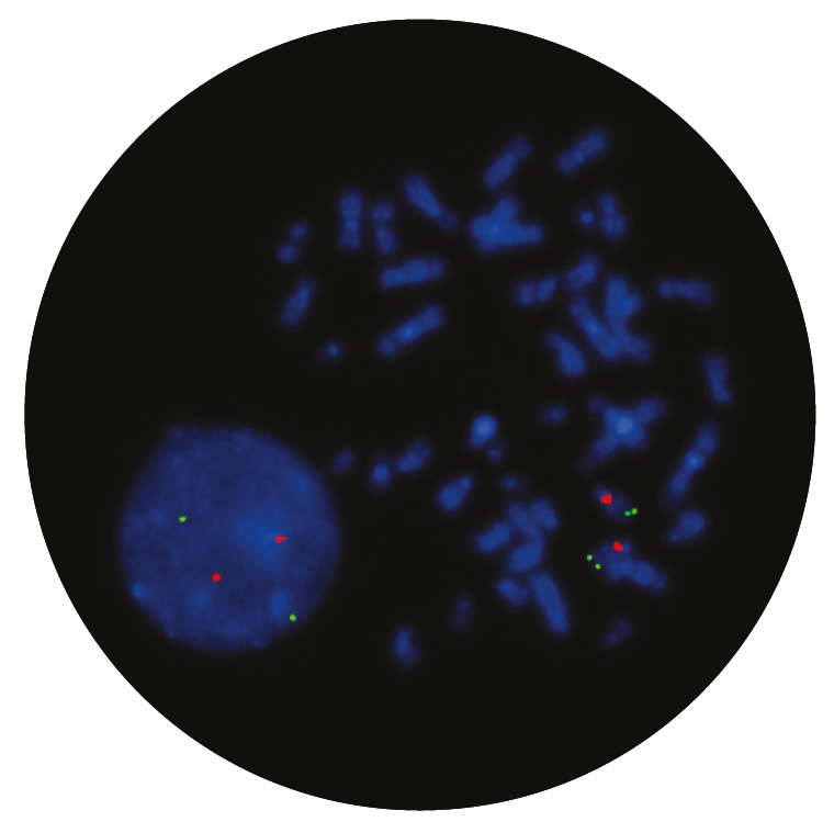 Fluorescence in situ hybridisation (FISH) microscope image of the CytoCell Angelman (UBE3A/D15S10) probe.