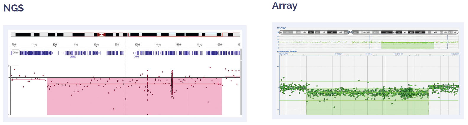 Software data showing the concordance between aCGH and NGS results for a 42.7Mb deletion of 11q covering ATM.