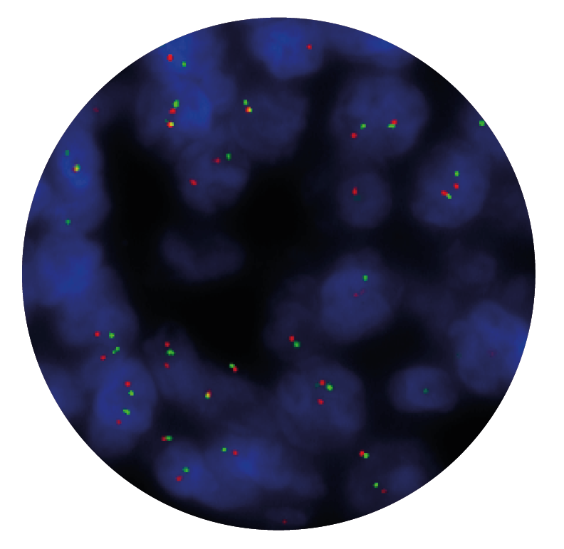 Fluorescence in situ hybridisation (FISH) microscope image of the CytoCell IGK Breakapart probe.