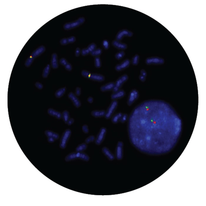 Fluorescence in situ hybridization (FISH) microscope image of the CytoCell IGK Breakapart probe.