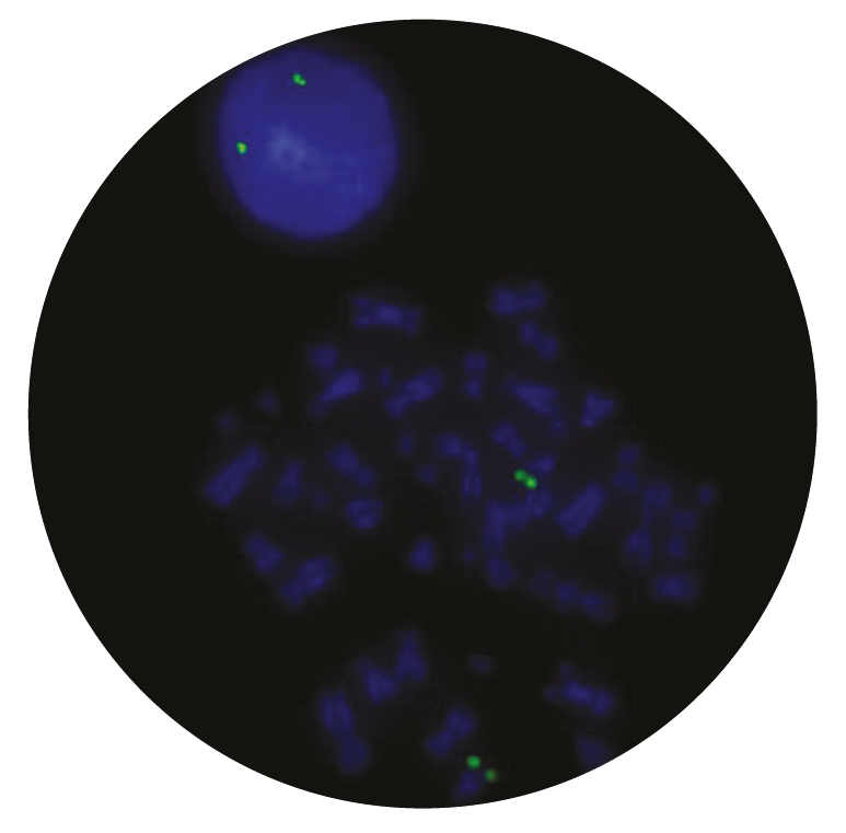 Fluorescence in situ hybridization (FISH) microscope image of the CytoCell IGH Plus probe.