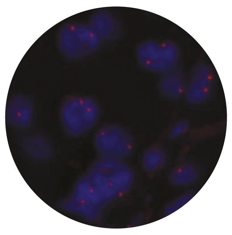 Fluorescence in situ hybridization (FISH) microscope image of the CytoCell RET Distal probe.