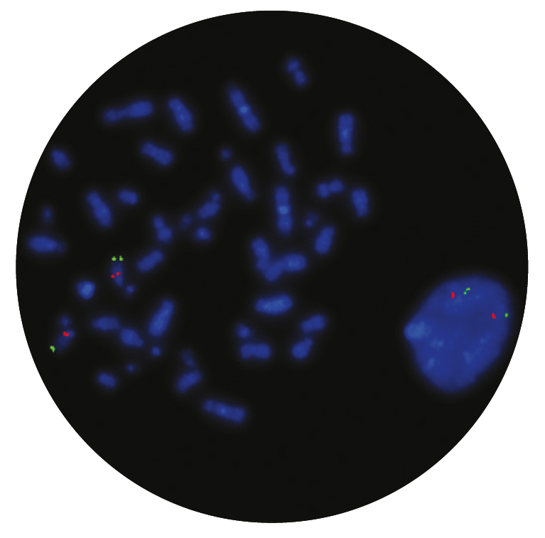 Fluorescence in situ hybridisation (FISH) microscope image of the CytoCell Prader-Willi/Angelman (SNRPN) probe.