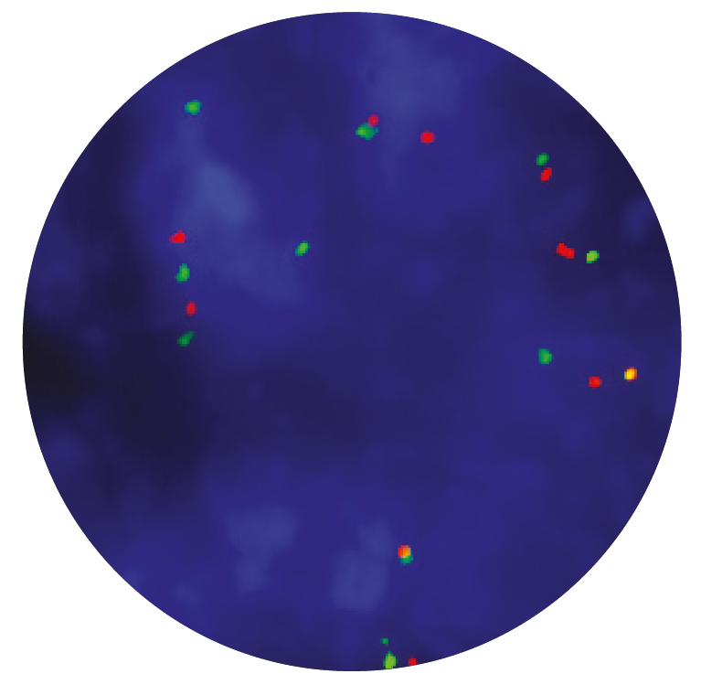 Fluorescence in situ hybridization (FISH) microscope image of the CytoCell MDM2 Amplification probe.