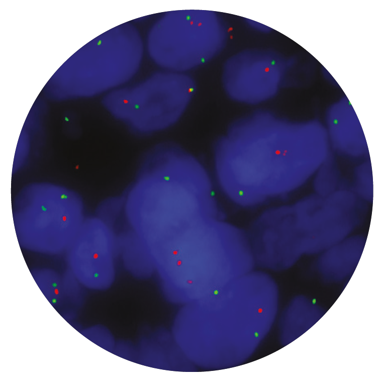 Fluorescence in situ hybridization (FISH) microscope image of the CytoCell SRD (CHD5) Deletion probe.