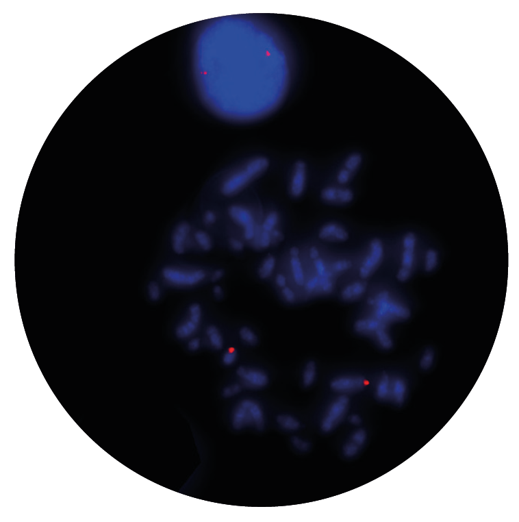 Fluorescence in situ hybridization (FISH) microscope image of the CytoCell P2RY8 Distal probe.