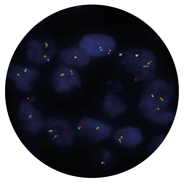 Fluorescence in situ hybridisation (FISH) microscope image of the CytoCell TMPRSS2/ERG Deletion/Breakapart probe.