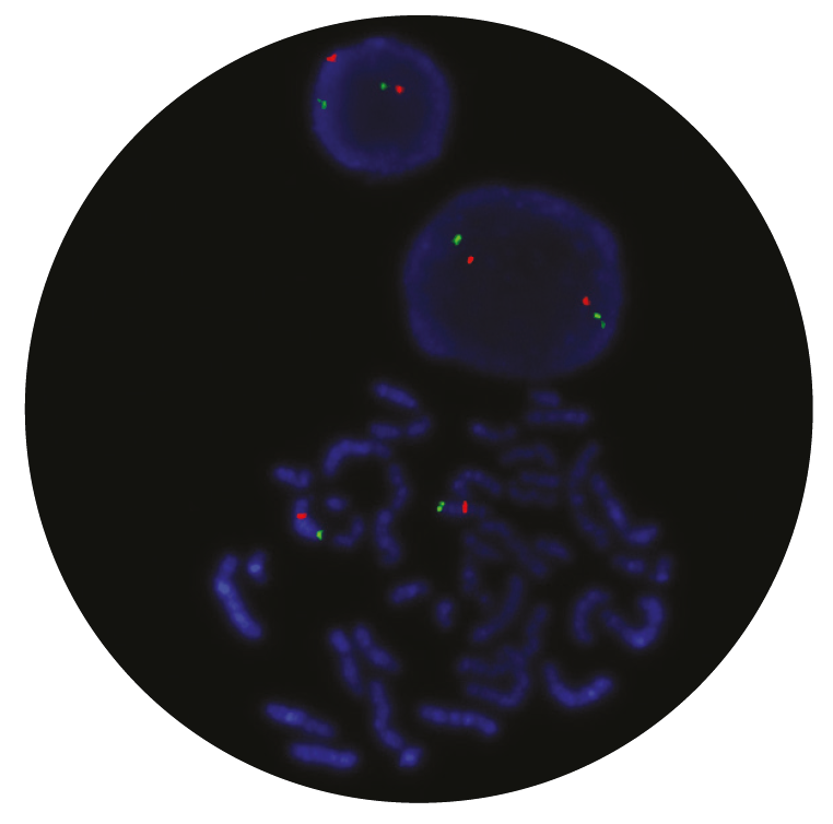Fluorescence in situ hybridization (FISH) microscope image of the CytoCell 13q14.3 Deletion probe.
