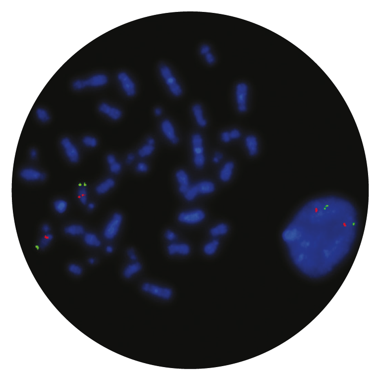 Fluorescence in situ hybridization (FISH) microscope image of the CytoCell Prader-Willi/Angelman (SNRPN) Region probe.