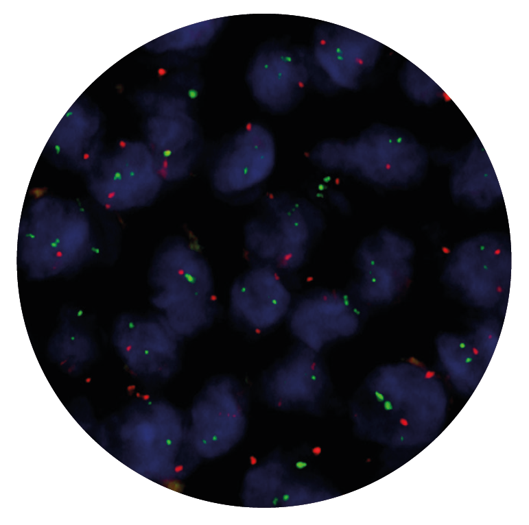 Fluorescence in situ hybridisation (FISH) microscope image of the CytoCell IGH/MALT1 Translocation, Dual Fusion probe.