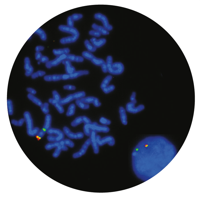 Fluorescence in situ hybridization (FISH) microscope image of the CytoCell Kallmann (KAL1) Region/STS Region probe.