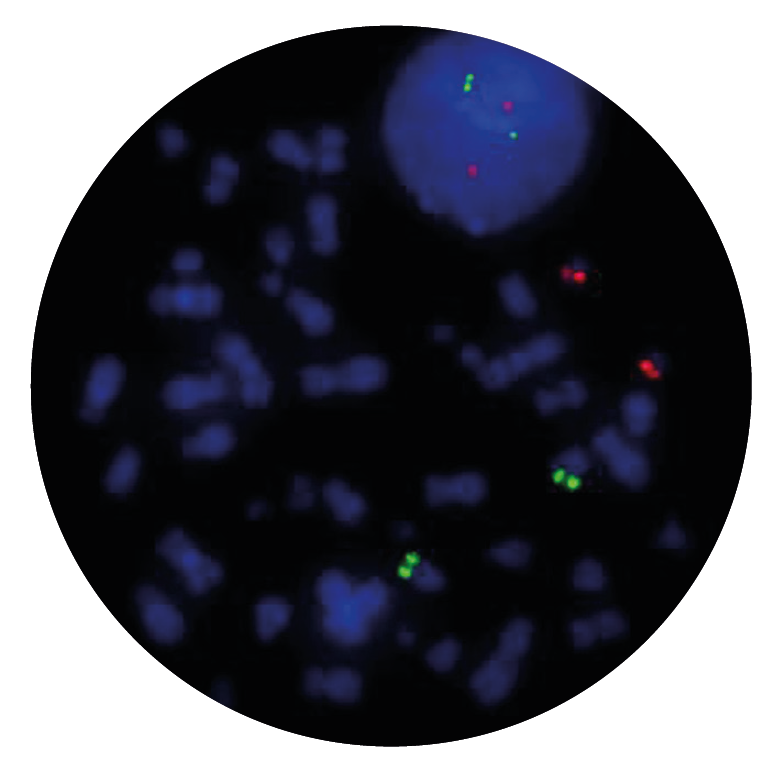 Fluorescence in situ hybridisation (FISH) microscope image of the CytoCell IGH/MAFB Plus Translocation, Dual Fusion probe.
