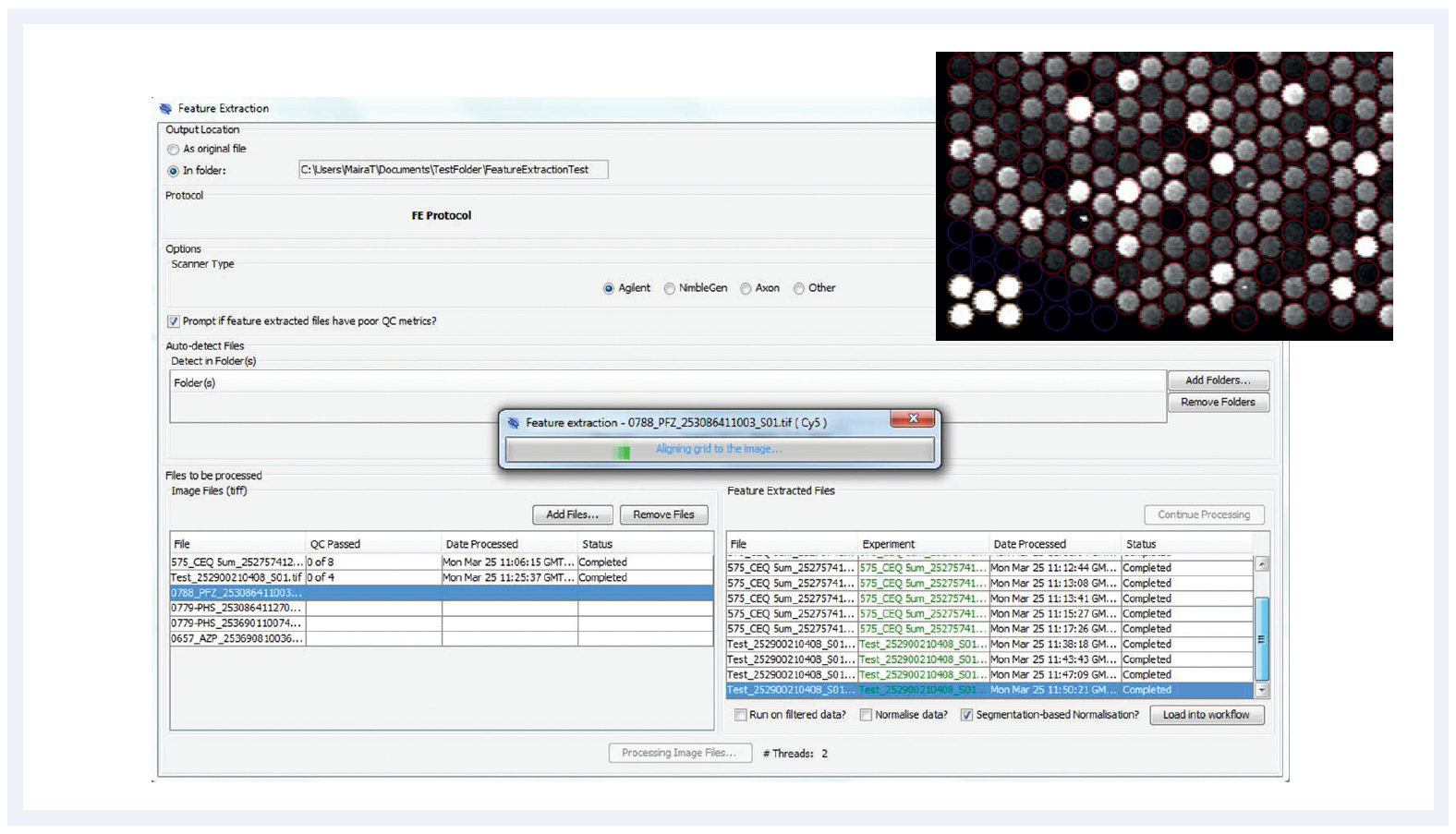 Screenshot showing automated array image analysis with CytoSure Interpret Software Feature Extraction Module.