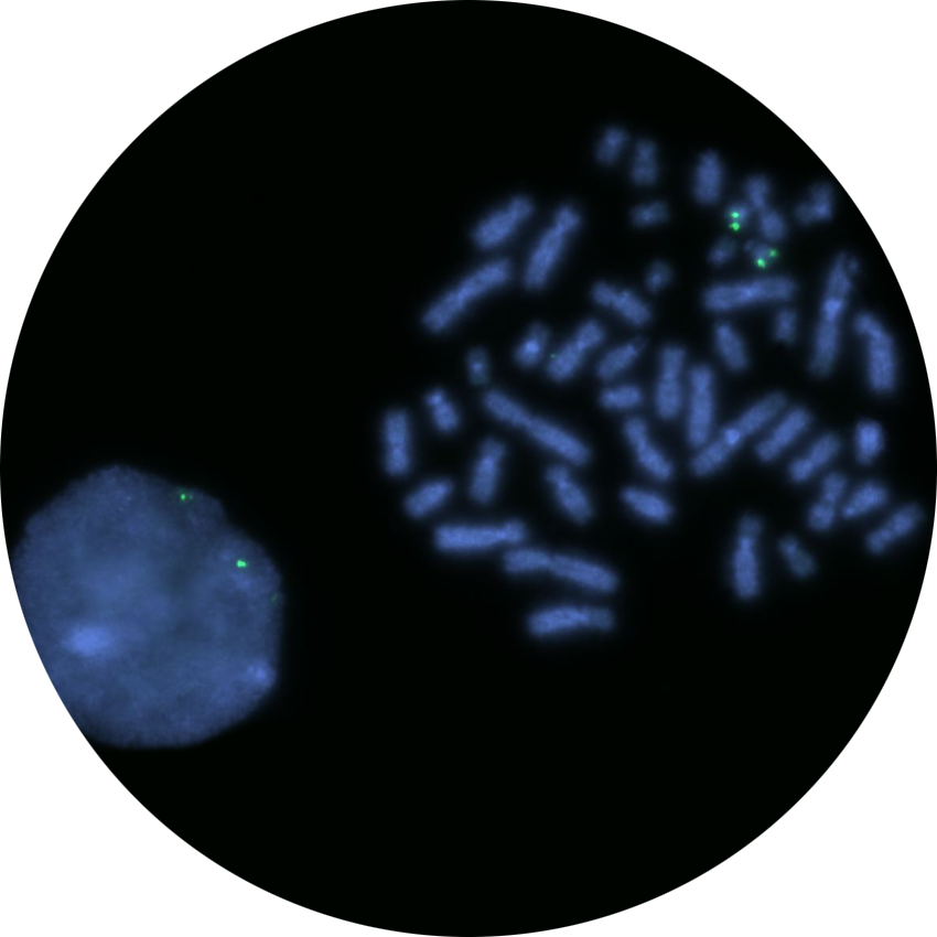 Fluorescence in situ hybridization (FISH) microscope image of the CytoCell AML1 (RUNX1) Distal Probe Green.