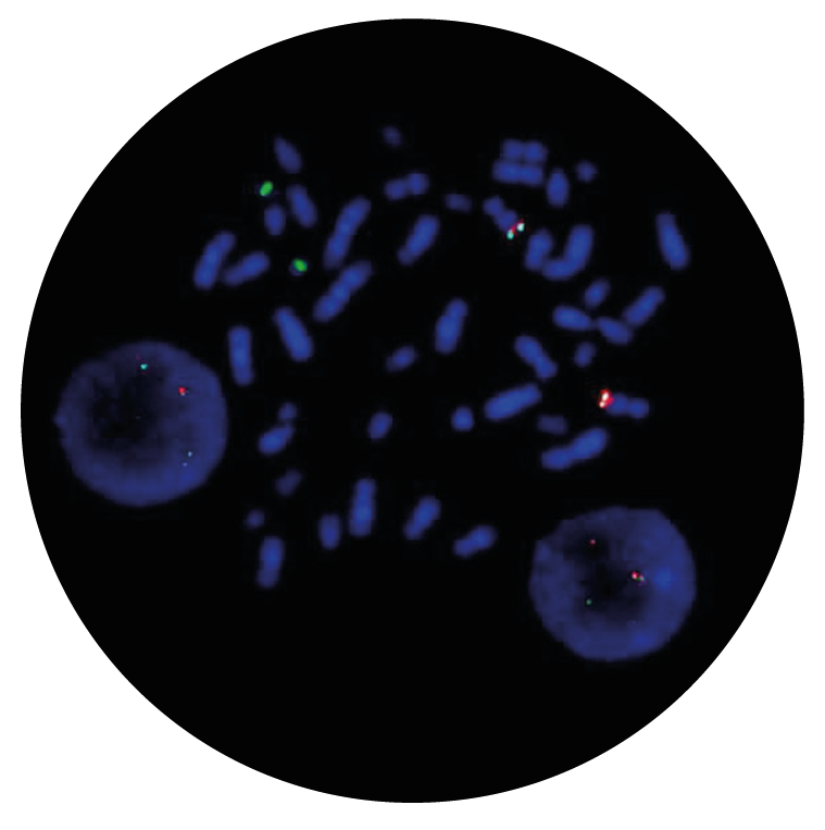 Fluorescence in situ hybridization (FISH) microscope image of the CytoCell BCR/ABL Plus Translocation, Dual Fusion probe.