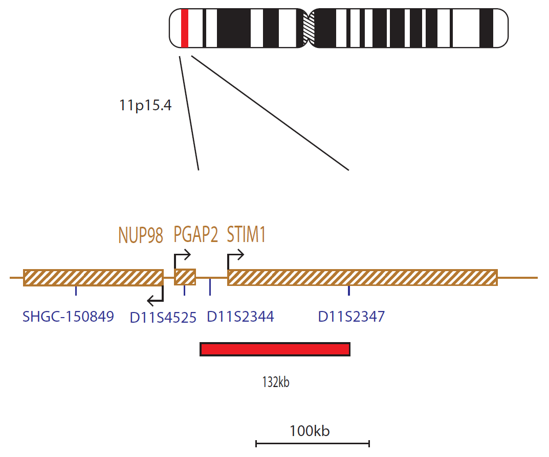Fluorescence in situ hybridization (FISH) chromosome map showing a probe proximal to the NUP98 gene.
